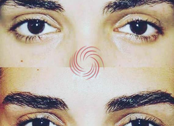 kaş ekim öncesi sonrası 4