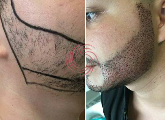 sakal ekim öncesi sonrası 1